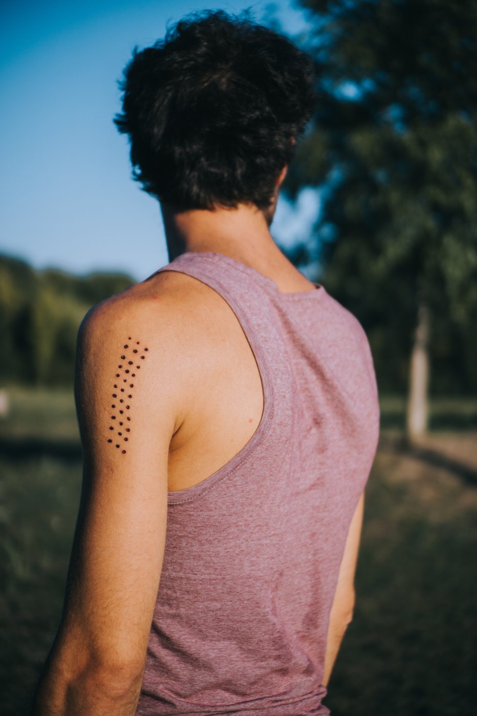 Person in a purple tank top showing fresh Kambo burn dots on their arm after a Kambo ceremony.